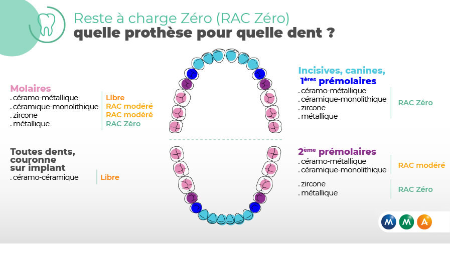 Infog_rac0_dentaire_897x5-1.jpg